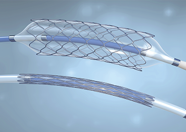 Image shows a balloon stent catheter with the balloon and stent expanded, with a closed version of the catheter beneath it.